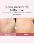 PDRN Pink Duo – švytėjimo ir drėkinimo rinkinys su peptidais ir hialuronu