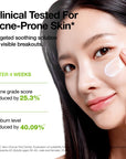 ANUA Azelaic Acid Cica Skin Soothing Moisturizer – raminamasis veido kremas