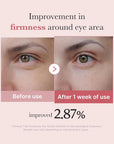 MEDICUBE PDRN Pink Peptide Eye Cream – stangrinantis paakių kremas