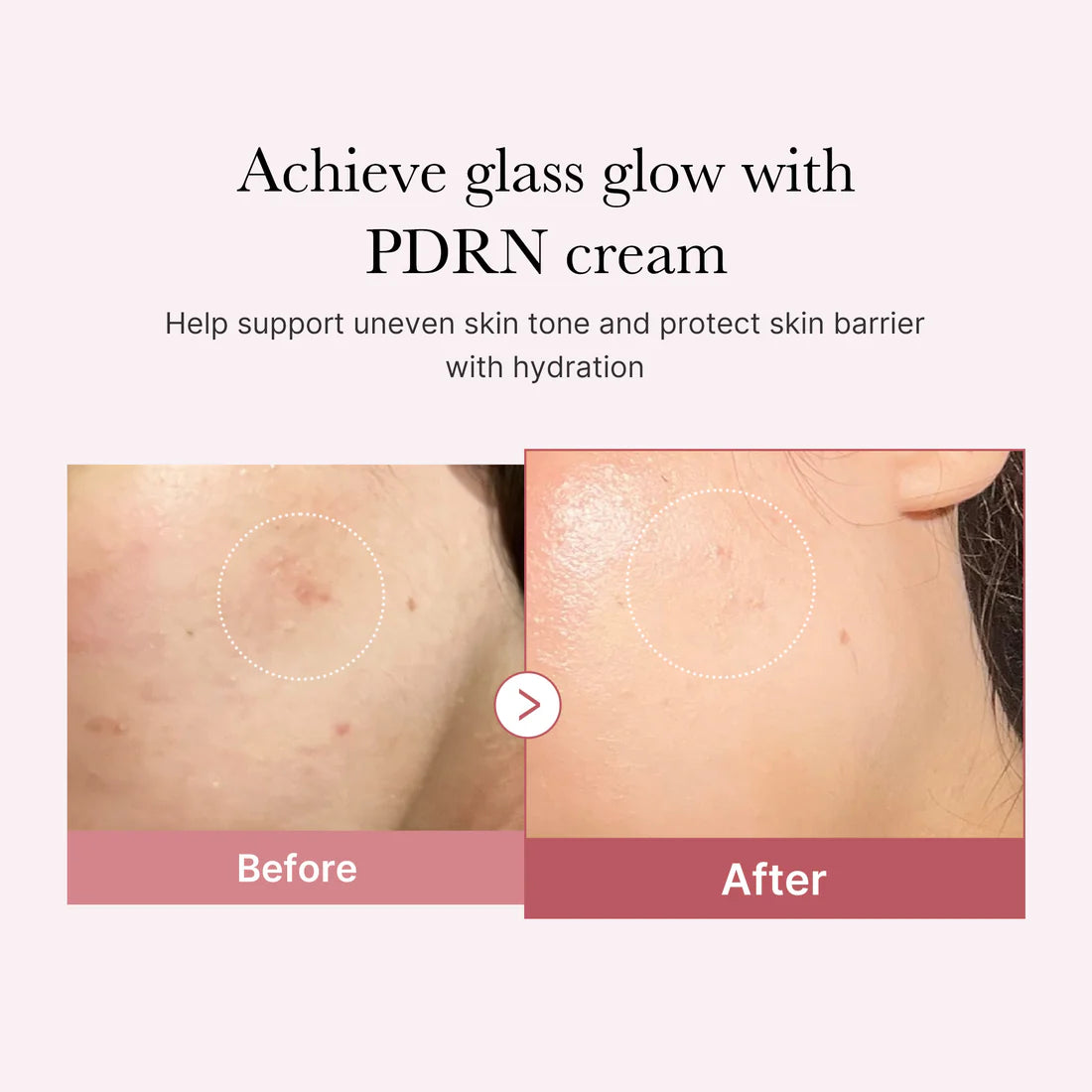PDRN Pink Duo – švytėjimo ir drėkinimo rinkinys su peptidais ir hialuronu