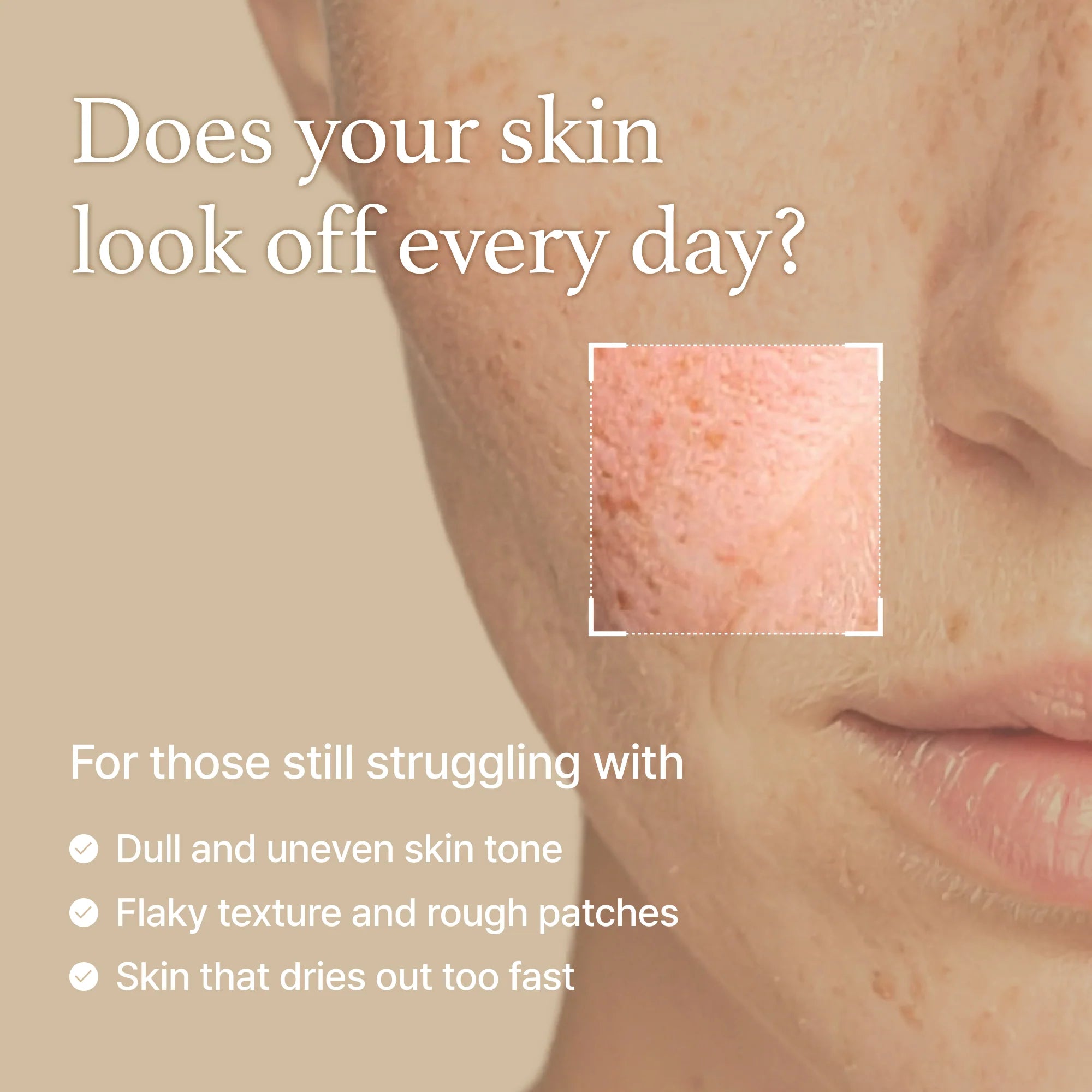 Rice Toner – veido tonikas su ryžių ekstraktu