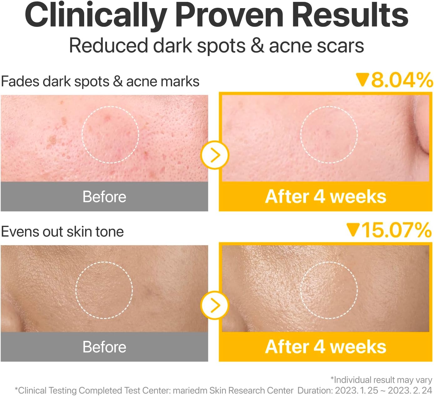 No. 5+ Glutathione Vitamin Concentrated Pad – dvipusiai padeliai veidui (70 vnt)