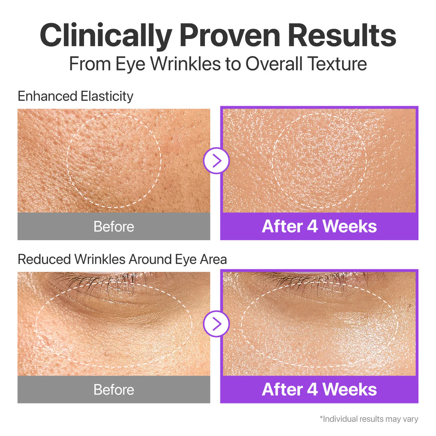 No.9 NAD rinkinys: Bio Lifting Essence - veido esencija + Bio Lifting-sil Full Face - veido kaukė + specialus tvarstis