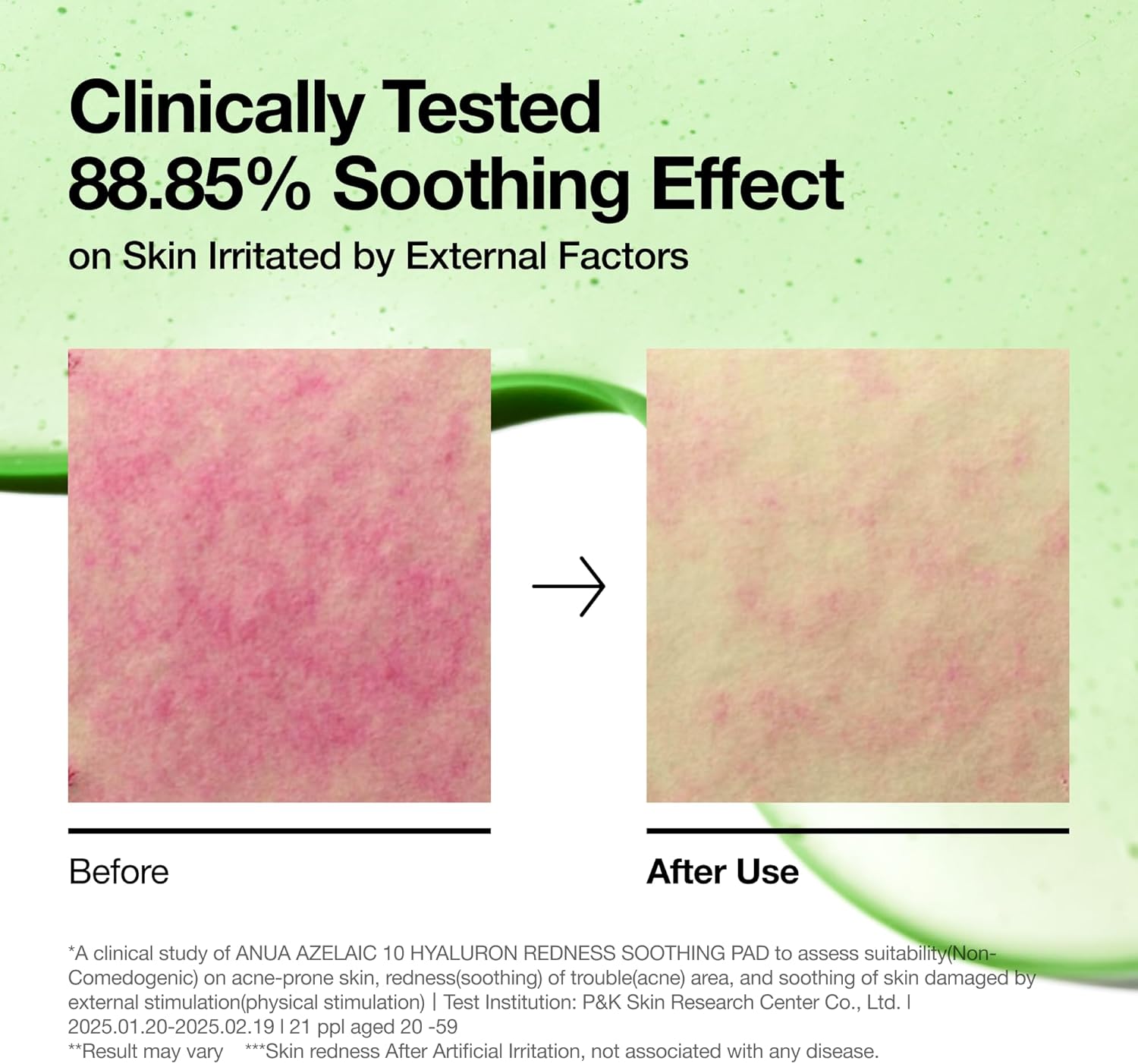 ANUA Azelaic Acid 10 Hyaluron Redness Soothing Pad – raminantys ir raudonį mažinantys veido padeliai