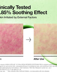 ANUA Azelaic Acid 10 Hyaluron Redness Soothing Pad – raminantys ir raudonį mažinantys veido padeliai