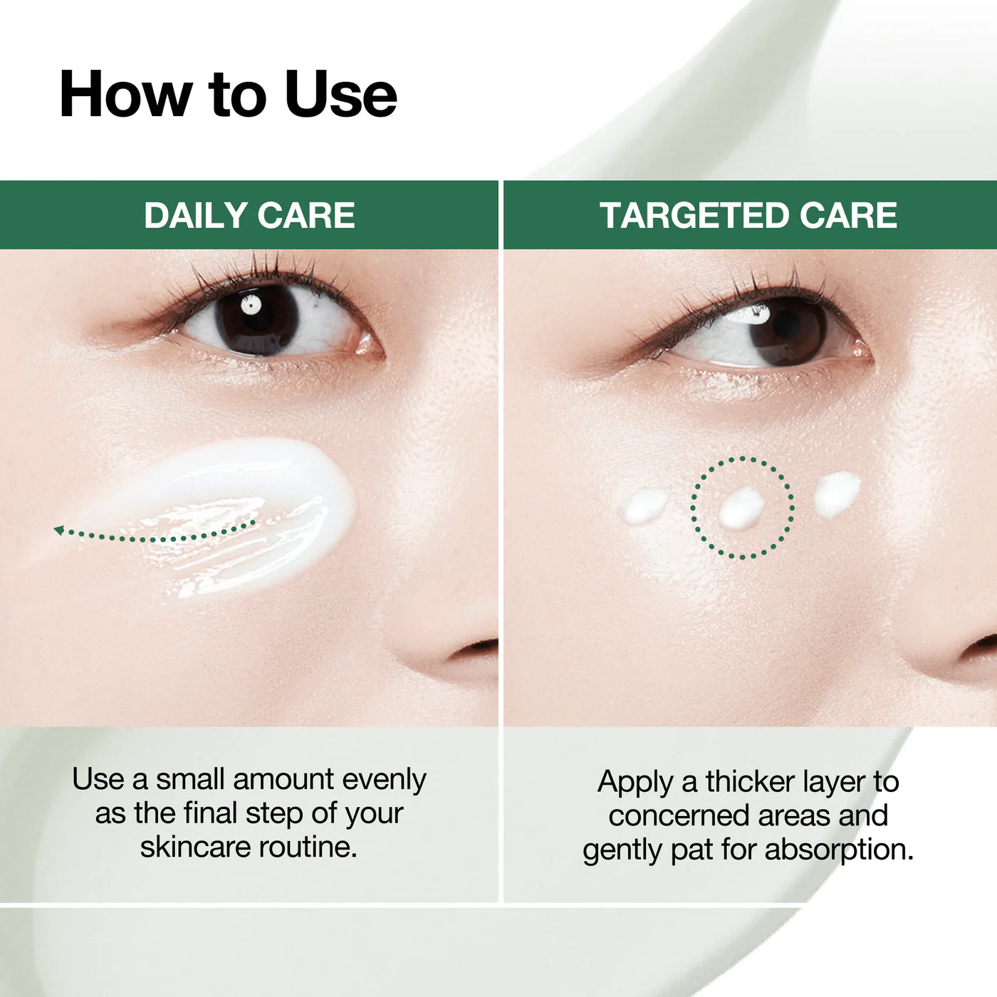 Centella Red Spot Cream – lokali priemonė spuogams