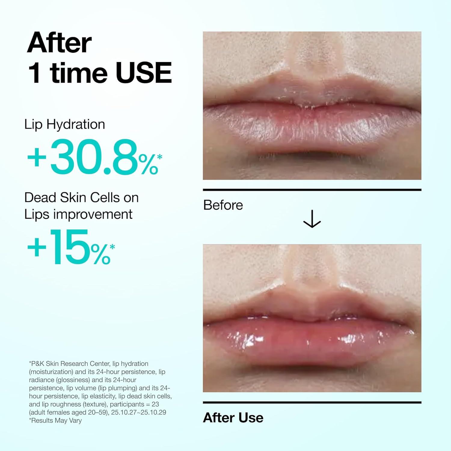 ANUA PDRN Lip Serum – drėkinamasis lūpų serumas