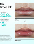 ANUA PDRN Lip Serum – drėkinamasis lūpų serumas
