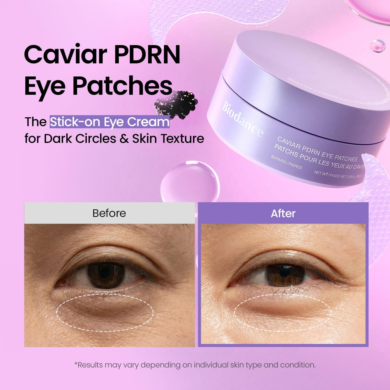 BIODANCE Caviar PDRN Eye Patches – regeneruojantys paakių padeliai