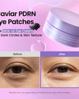 BIODANCE Caviar PDRN Eye Patches – regeneruojantys paakių padeliai