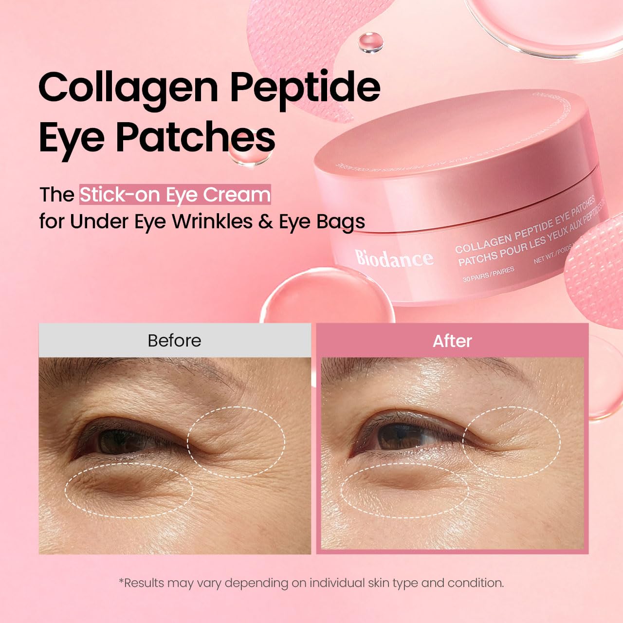BIODANCE Collagen Peptide Eye Patches – stangrinantys paakių padeliai