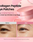 BIODANCE Collagen Peptide Eye Patches – stangrinantys paakių padeliai