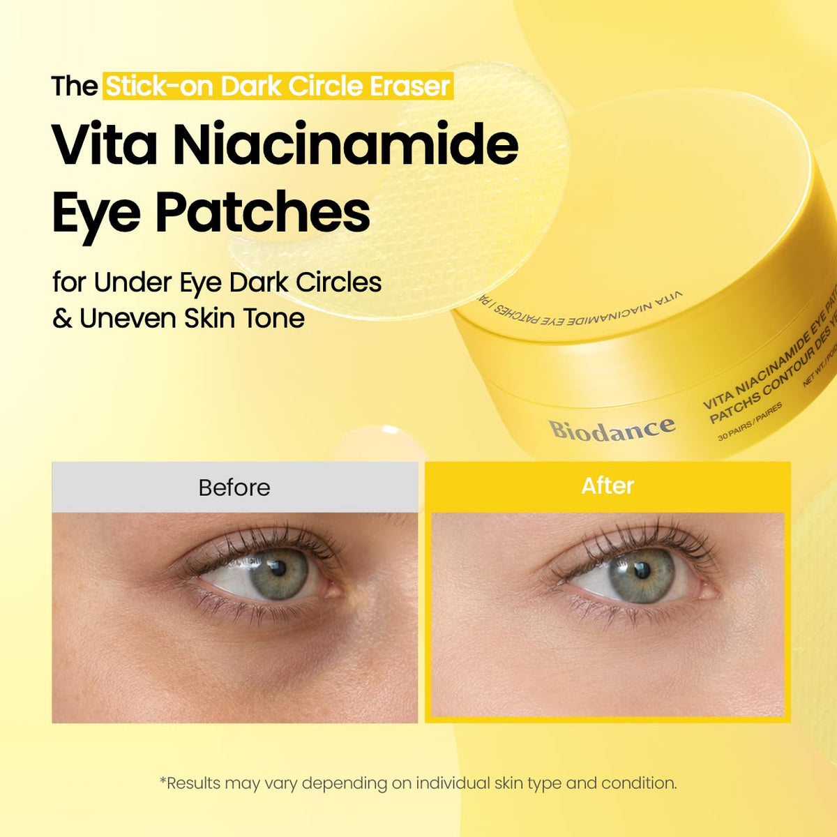 BIODANCE Vita Niacinamide Eye Patches – šviesinantys paakių padeliai nuo patamsėjimų