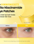 BIODANCE Vita Niacinamide Eye Patches – šviesinantys paakių padeliai nuo patamsėjimų