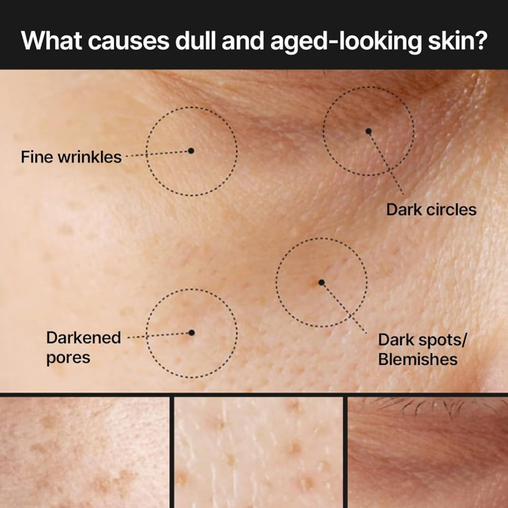 CELIMAX Pore+Dark Spot Brightening Cream – skaistinantis kremas porų ir pigmentinių dėmių priežiūrai