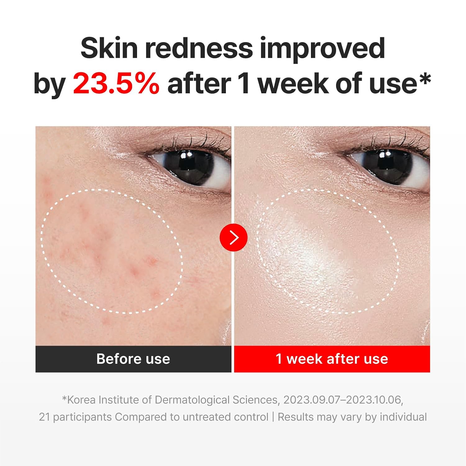 CENTELLIAN24 Madeca Cream Time Reverse – atkuriamasis ir stangrinantis veido kremas