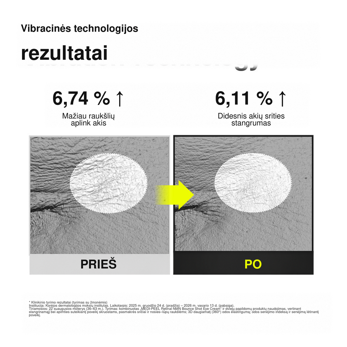 MEDIPEEL Retinal NMN Bounce Shot Eye Cream – stangrinamasis paakių kremas su vibruojančiu aplikatoriumi