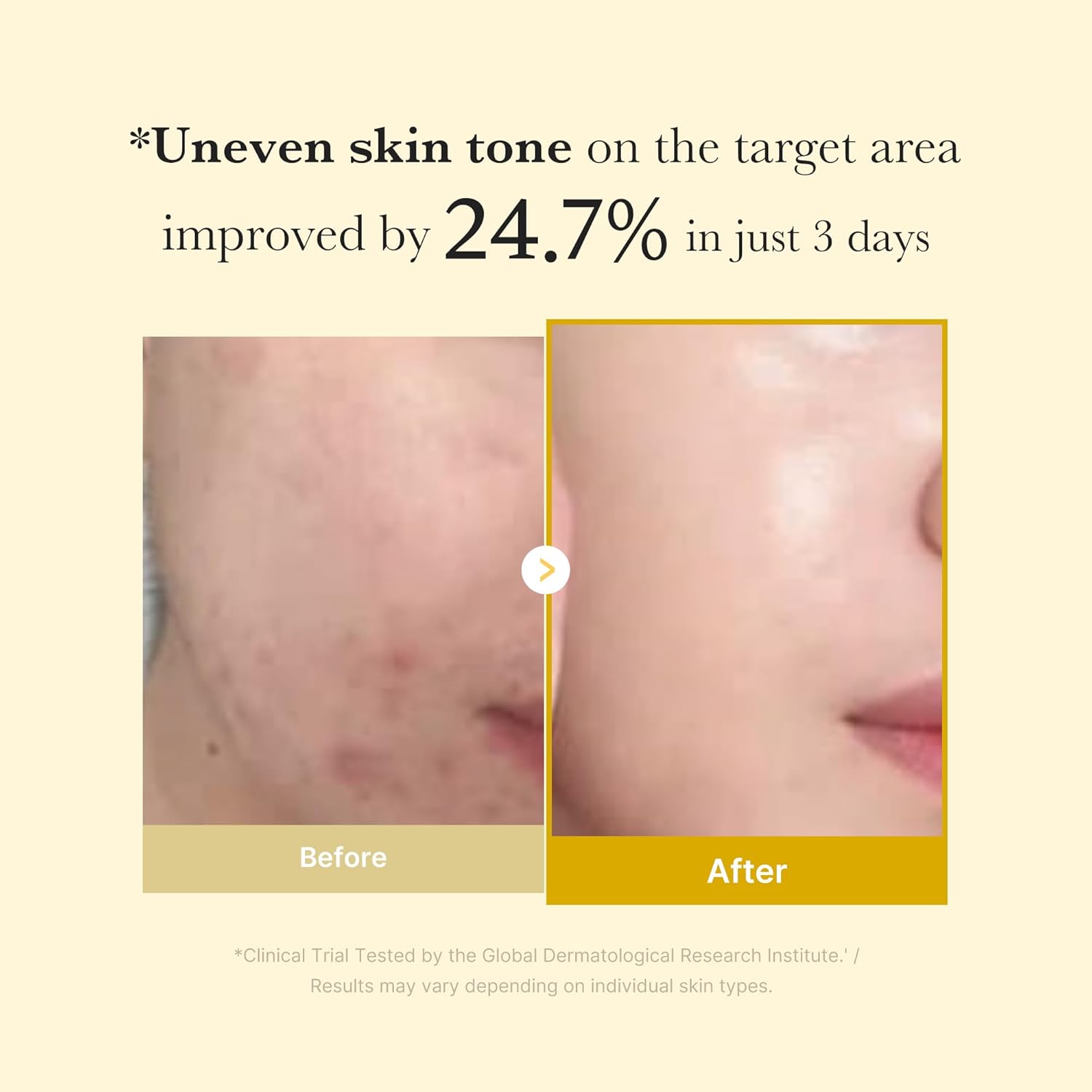 MEDICUBE Kojic Acid Turmeric Night Wrapping Mask – naktinė skaistinanti veido kaukė