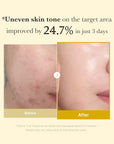 MEDICUBE Kojic Acid Turmeric Night Wrapping Mask – naktinė skaistinanti veido kaukė