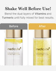 MEDICUBE Kojic Acid Turmeric Vita Jelly Mist Serum – skaistinanti seruminė veido dulksna