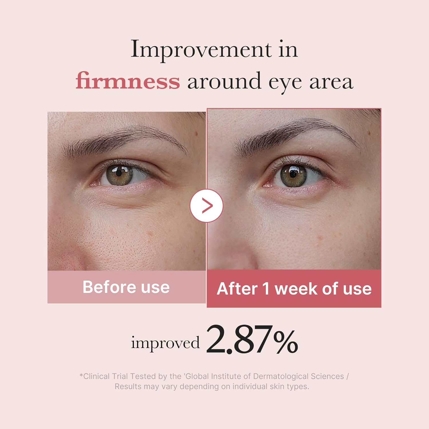 MEDICUBE PDRN Pink Peptide Eye Cream – stangrinantis paakių kremas