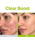 PURITO SEOUL Azelaic Acid 10 Kojic Tea Tree Serum – veido serumas