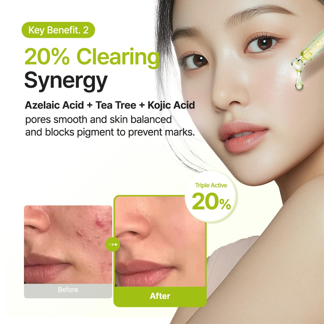 PURITO SEOUL Azelaic Acid 10 Kojic Tea Tree Serum – veido serumas