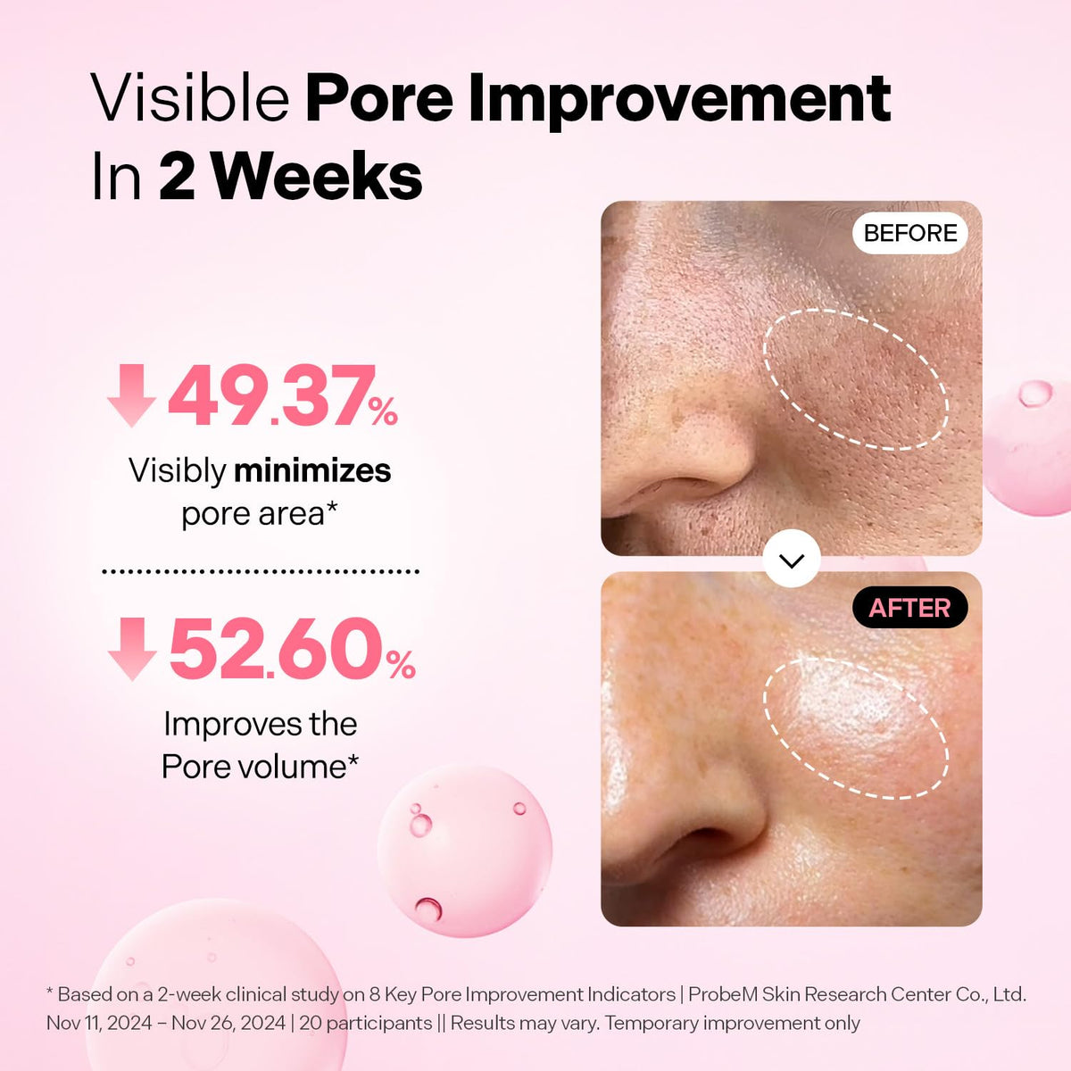 TORRIDEN CELLMAZING Pore Perfecting Ampoule – stangrinantis veido serumas