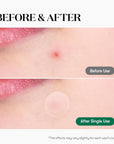 VT COSMETICS Cica Spot Patch – hidrokoloidiniai pleistrai spuogams su CICA (48 vnt)