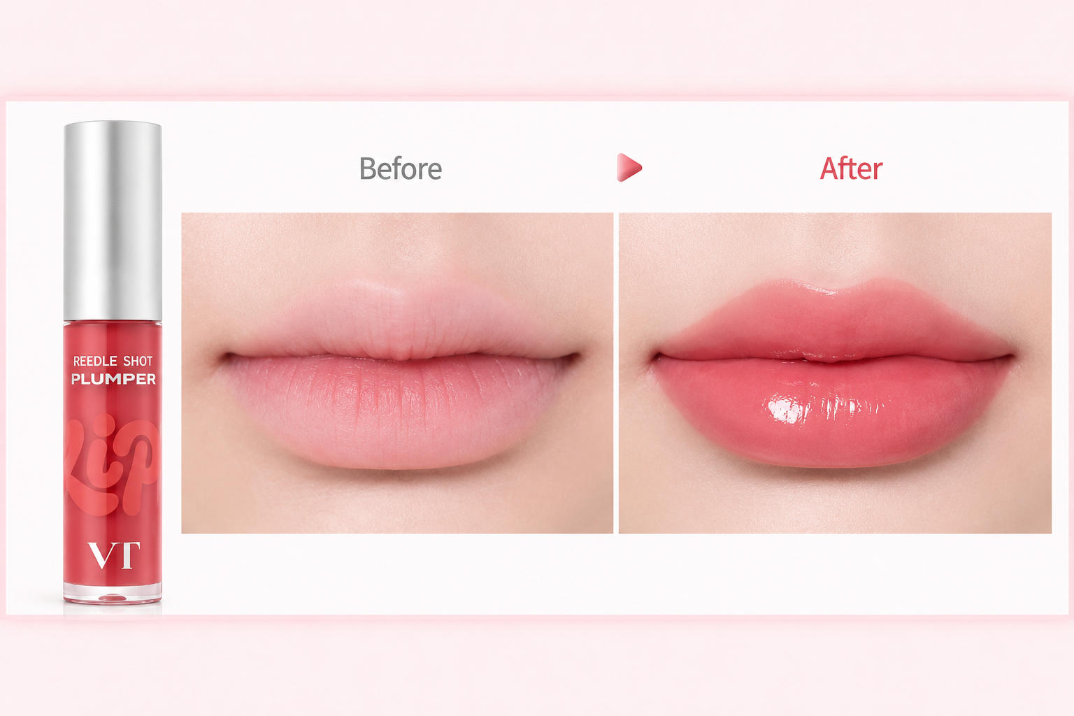 VT COSMETICS Reedle Shot Essence Lip Plumper 03 Soft Pink– drėkinantis lūpų putlintojas